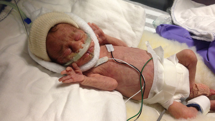 Klinik-Blog: Geschichte Mutter mit Baby auf Neugeborenen-ITS