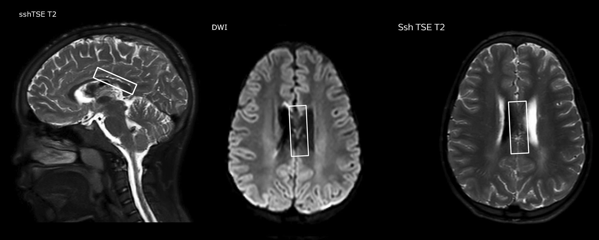 eine Nahaufnahme eines Gehirnscans