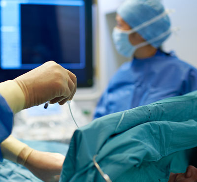 Informationen zur Sondenextraktion