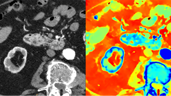 eine Nahaufnahme eines Scans eines Gehirns