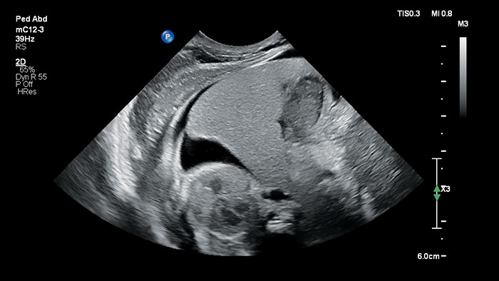 Leber&nbsp;&ndash; transversal