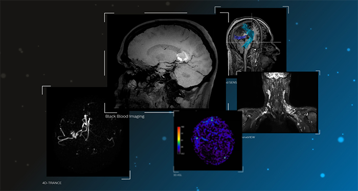 L&ouml;sungen f&uuml;r die neurologische Diagnose​