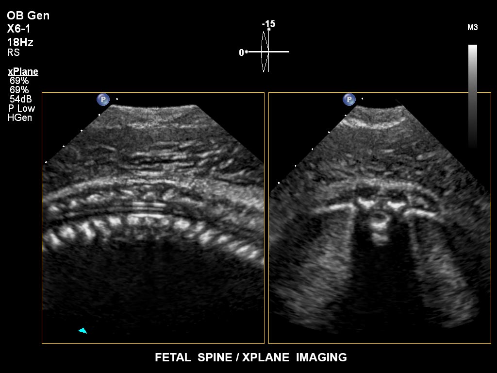 Ultraschallbild Gyn&auml;kologie Beispiel 16