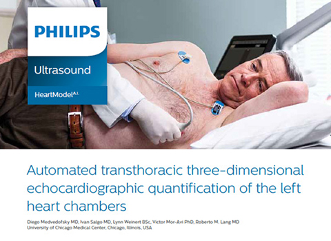 &bdquo;Automated transthoracic 3D echo quantification of the left heart chambers&ldquo; (Automatische transthorakale 3D-Echoquantifizierung der linken Herzkammern)